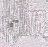 الحزم الوعائية الليفية