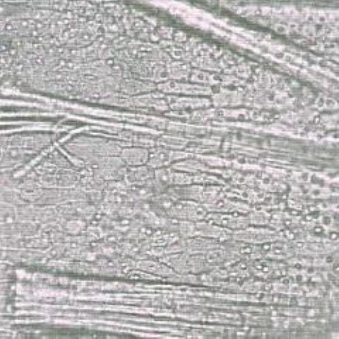 Surface view of leaf