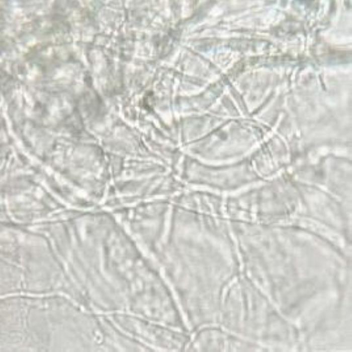 أﻟﯿﺎف ﻣﺘﺸﻌﺒﺔ