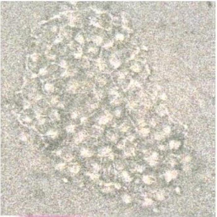 Upper epidermis