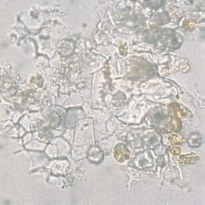 Palisade cells