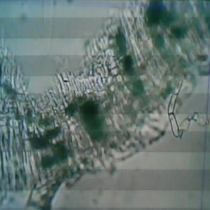 TS of leaf