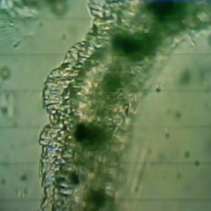 TS of stem