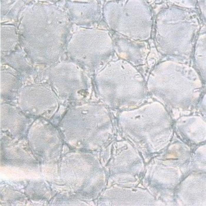 Surface view of stem pith