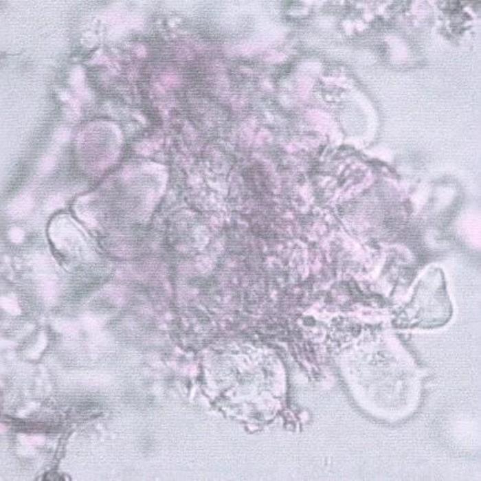 TS of stem