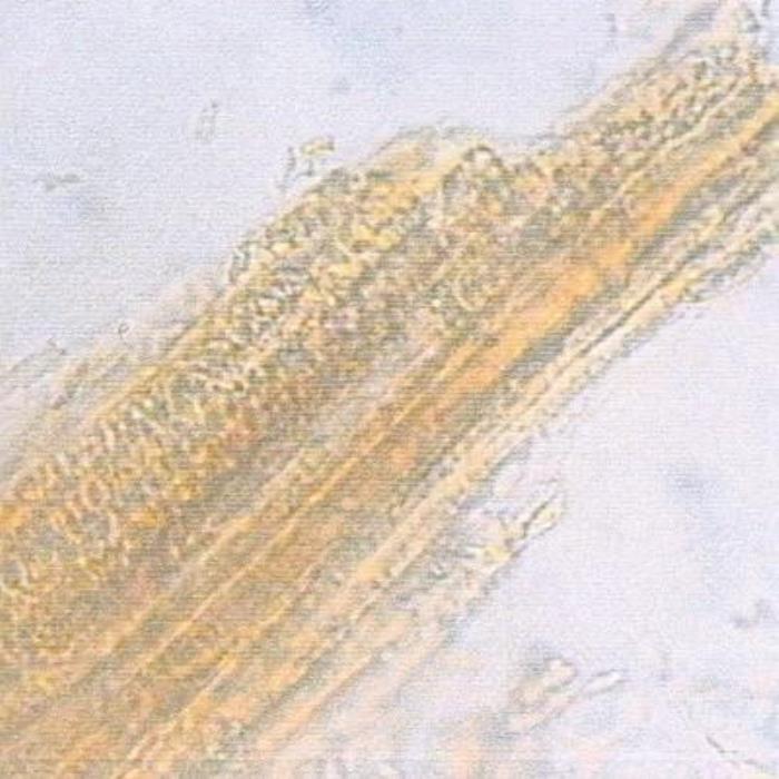 Vascular tissues