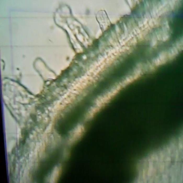 TS of stem