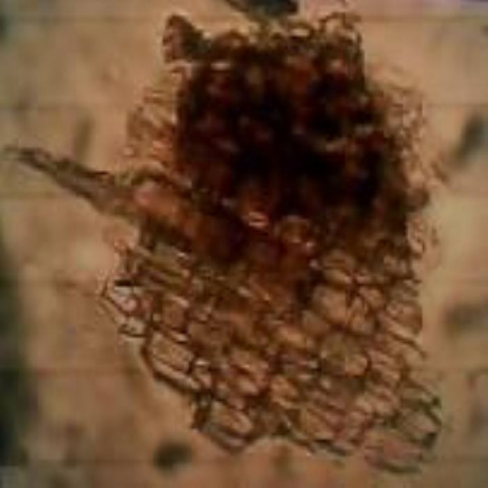 Stem surface view